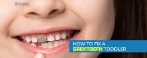 How to Fix a Grey Tooth Toddler: Causes & Treatment Options