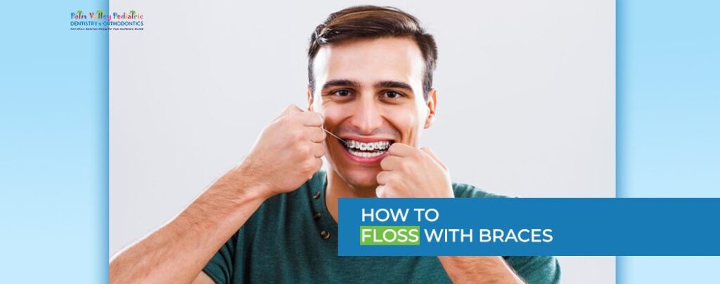 Flossing with Braces: Health Benefits, Methods & Expert Tips