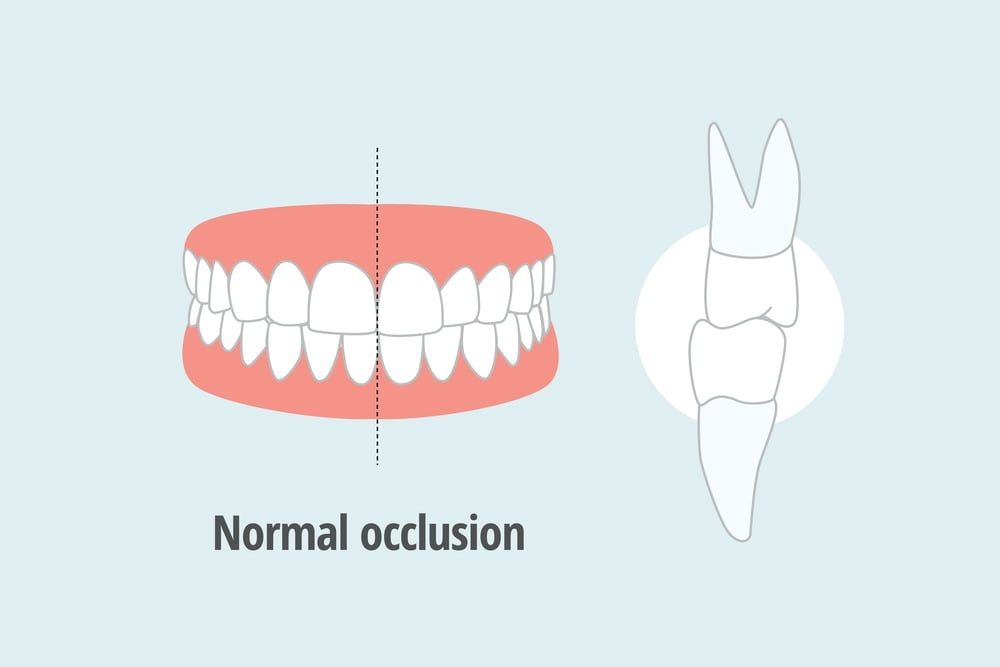 Perfect Teeth Alignment Perfect Teeth Alignment