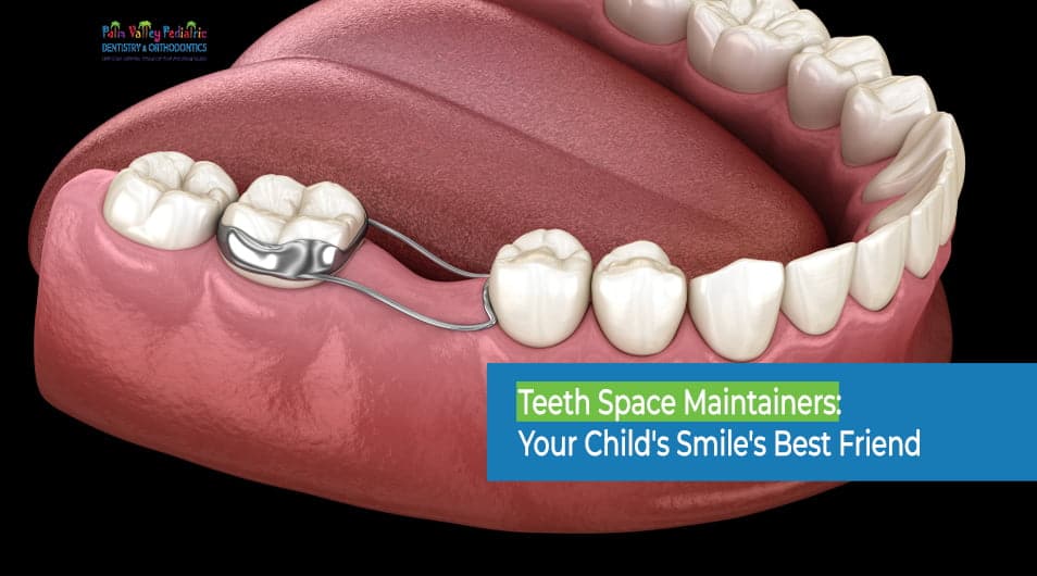 Teeth Space Maintainers: Your Child’s Smile’s Best Friend