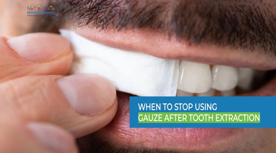 Optimal Timing: When to Cease Gauze Use After Tooth Extraction