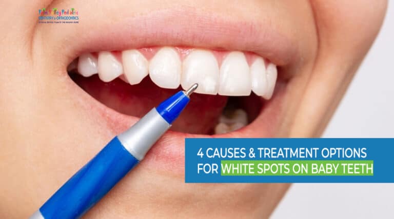 What are the White Spots on Baby Teeth, Their Causes and Treatment