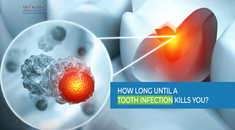 How Long Until a Tooth Infection Kills You (4 Risk Factors)
