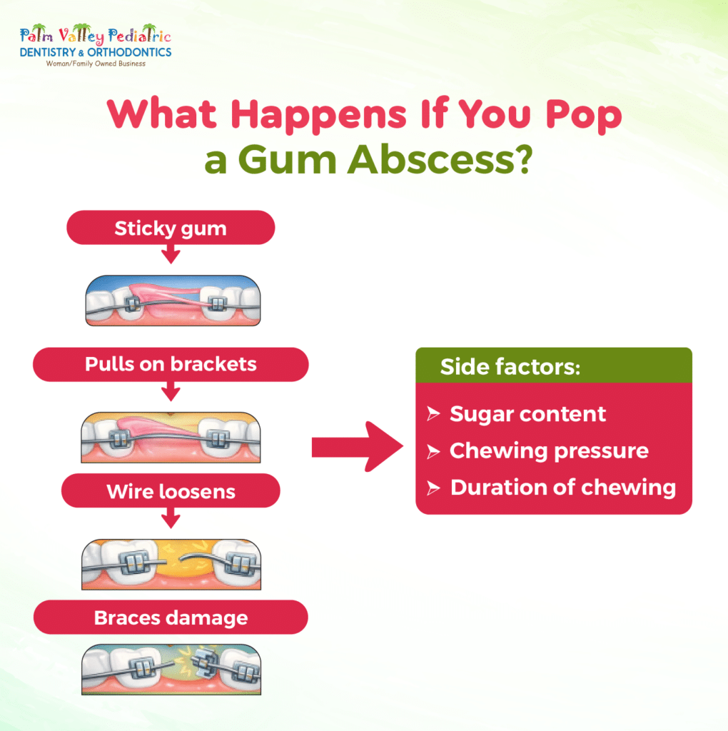 Infographic explaining what happens if you pop a gum abscess