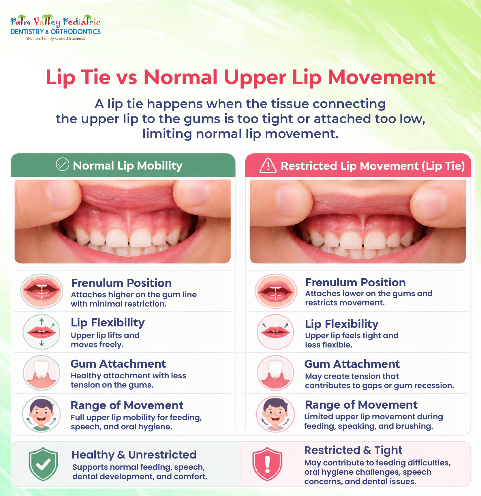 Lip Tie Problems Later in Life [+ Treatments]